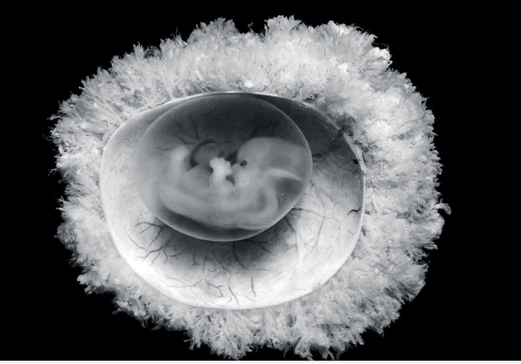 第45天的人类胚胎；摄影：Omikron/Science Source.