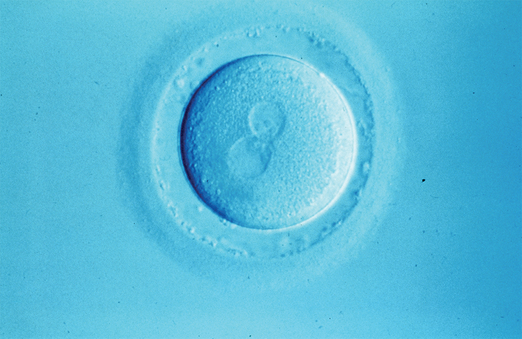 一颗刚授精的人类卵子中的两个亲代原核. 图片：Alan Handyside.