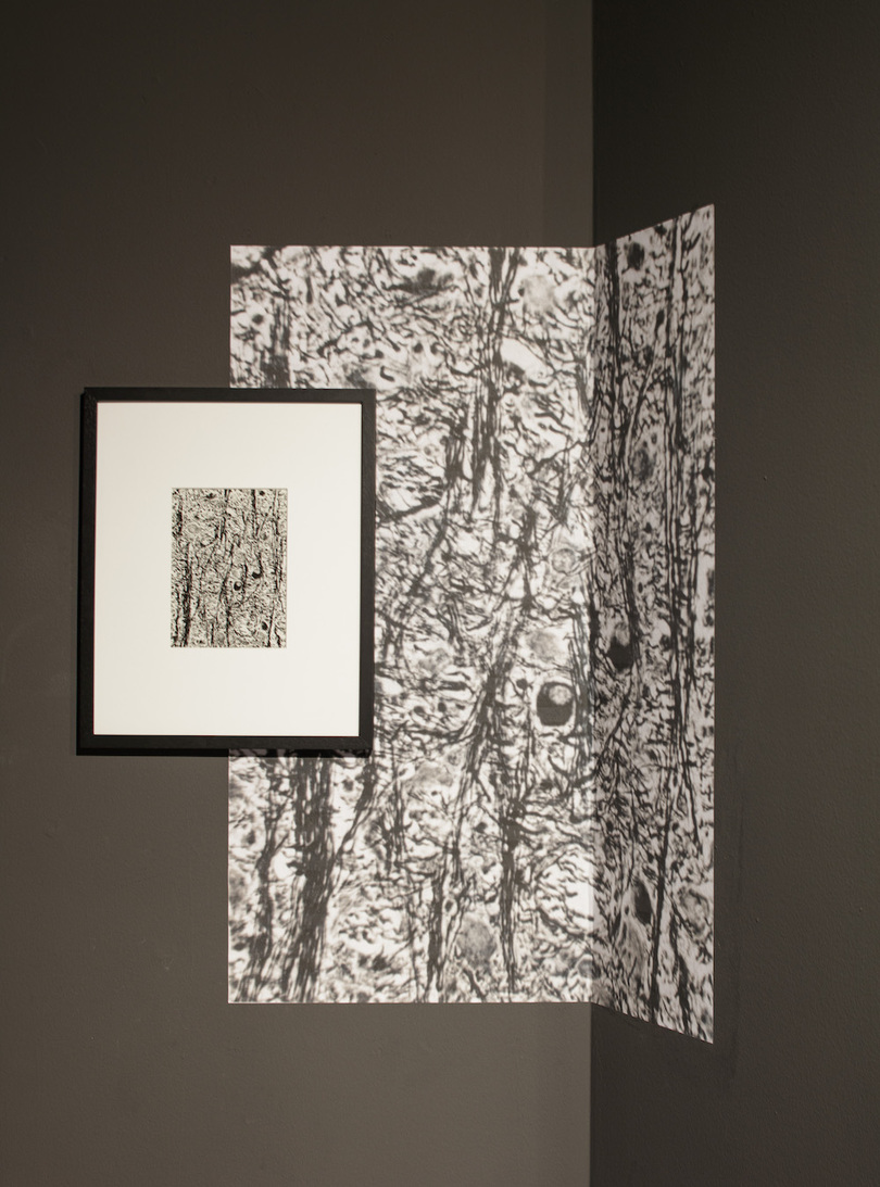 阿尔弗雷德·艾哈特，《脑桥纤维束（人）》，1939，银盐打印，9 1/2 X 7”. 柏林罗莎·卢森堡广场艺术协会展览现场. 摄影：Ludger Paffrath.