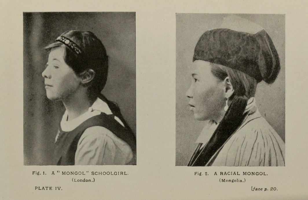 由F. G. 克鲁克山克著述的《我们之中的蒙古人》（The Mongol in our Midst）书中对于“唐氏症”与所谓的“蒙古人种”进行外观上的比较. 图片：F. G. Crookshank, The Mongol In Our Midst: A Study of Man And His Three Faces, P. Blakiston’s Son &amp; Co., 1910. Digitized by Yale University.