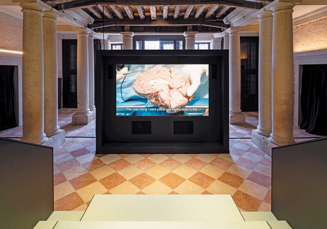 “人类大脑：一切始于思想”展览现场，2022，普拉达基金会，威尼斯. 中间：苏珊娜·S·斯坦萨斯（Suzanne S. Stensaas），《人脑简介》（Introduction to the Human Brain），2015. 摄影：Marco Cappelletti.