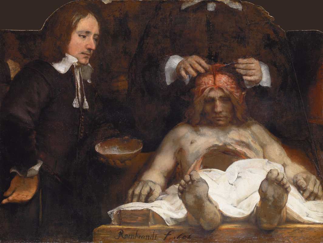 伦勃朗·范·莱茵，《约安·德曼医生的解剖课》（The Anatomy Lesson of Dr Joan Deyman），1656，布面油画，393⁄8 × 523⁄8".